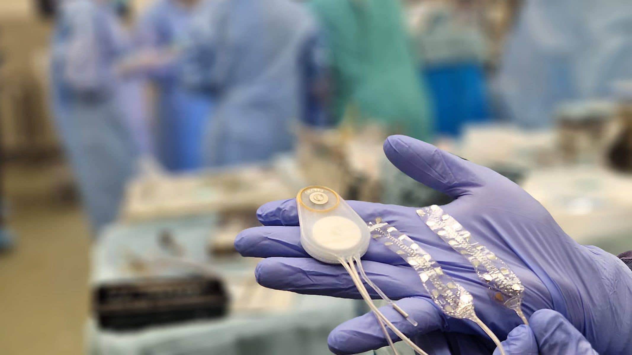 A hand in a surgical glove holds CorTec's Brain Interchange System device in a medical setting.