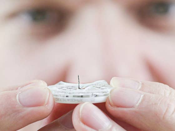 Apple to use lasers for its noninvasive blood glucose monitoring on watches