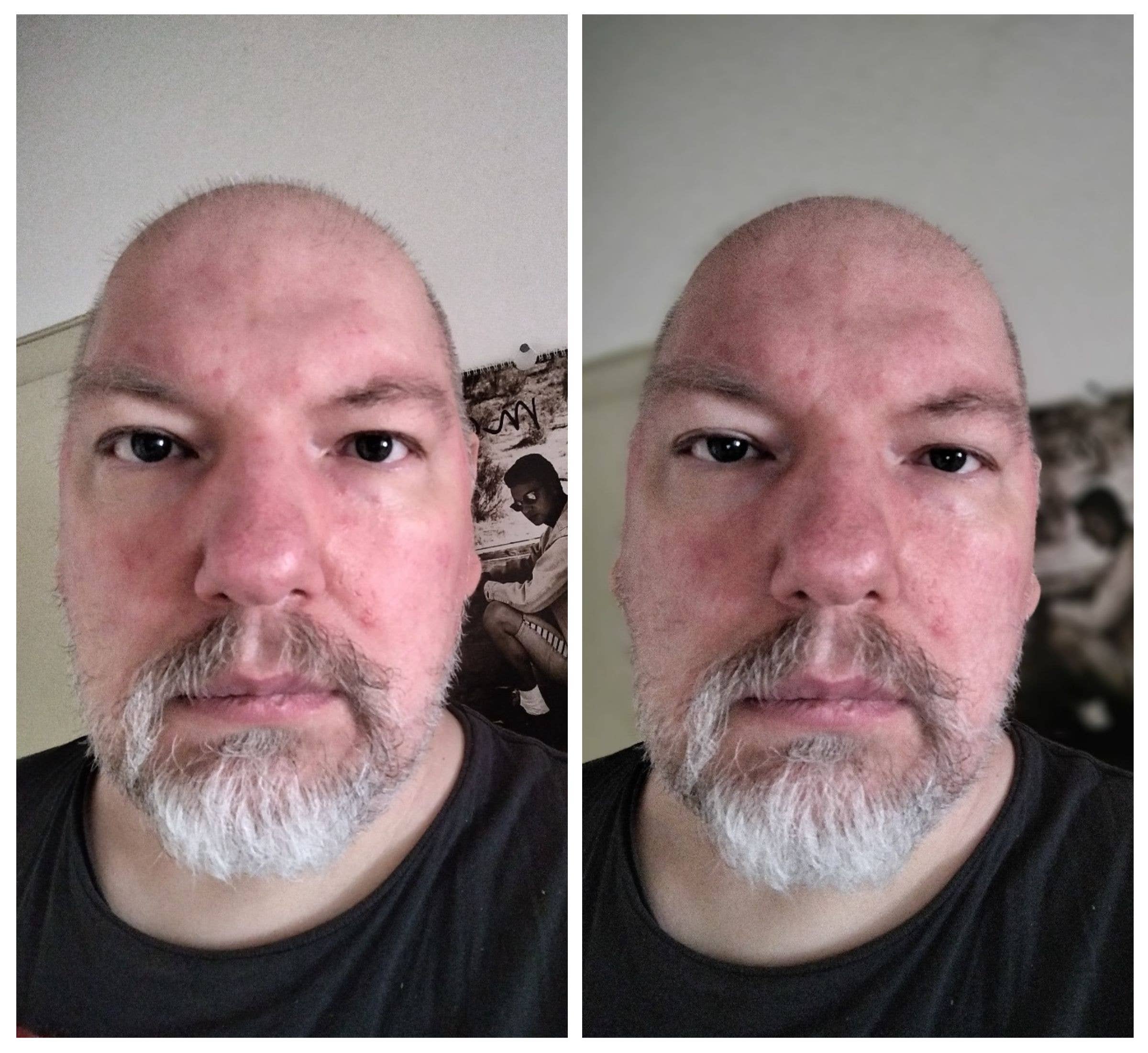 Nokia X20 Sample Pic Selfie