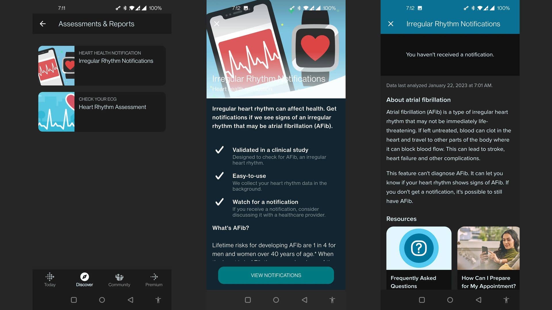 Fitbit Irregular Heart Rhythm for Google Pixel Watch