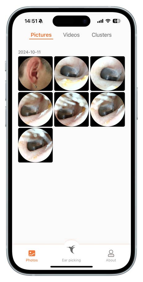 Bebird app interface showing images of ear cleaning procedures.