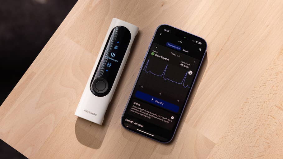 A Withings BeamO device next to a smartphone displaying ECG data.