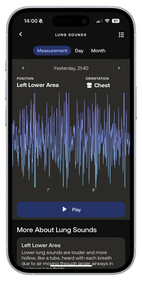 Mobile app screen displaying lung sounds measurement for left lower area.