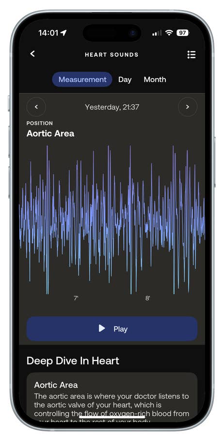 Screen displaying heart sounds measurement with a graph and details about the aortic area.