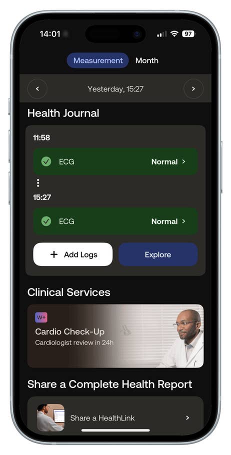 Health Journal on a smartphone showing ECG results and options for adding logs and exploring services.