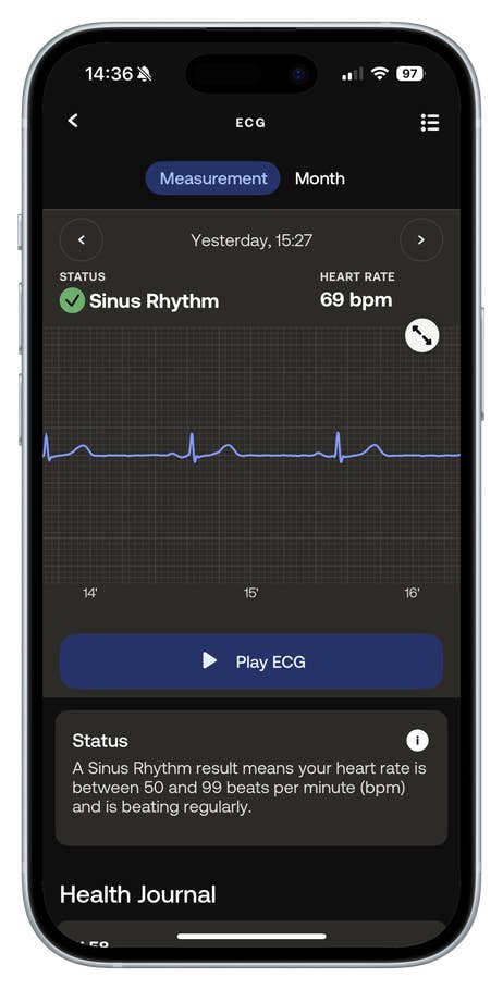 ECG reading on a smartphone showing sinus rhythm and heart rate of 69 bpm.