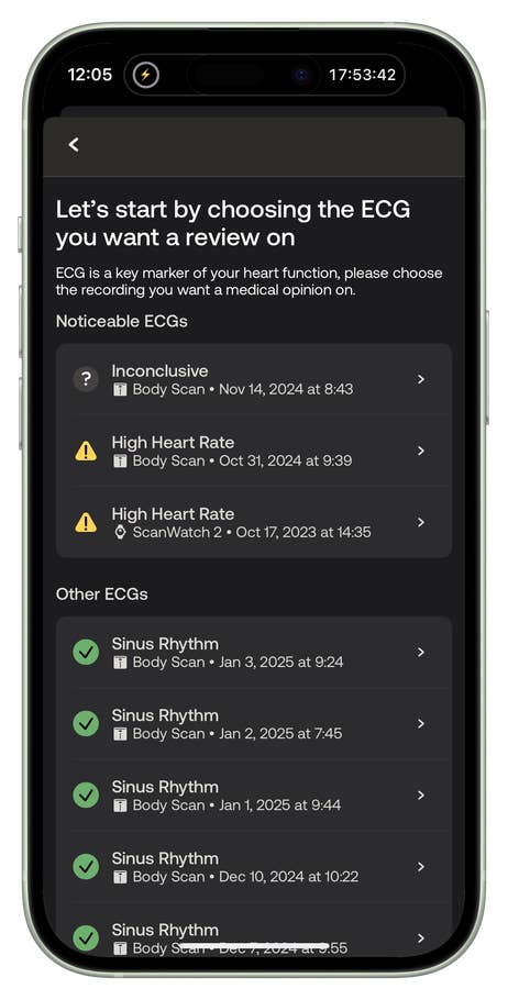 Mobile app screen showing ECG options, including Inconclusive and High Heart Rate alerts.