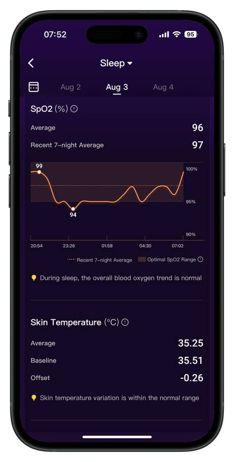 Screenshots of the RingConn Gen 2 Smart Ring app companion user interface.