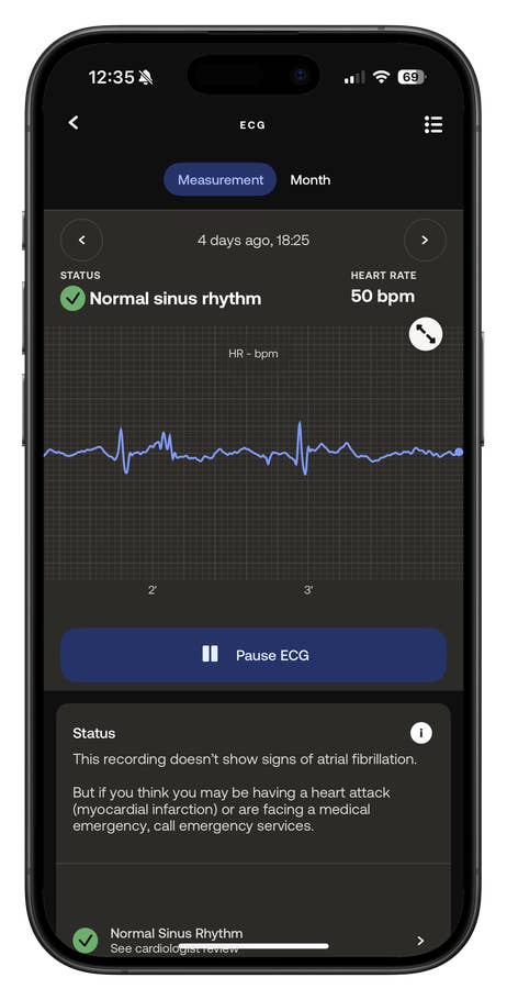 ECG recording from the Withings ScanWatch Nova showing a normal sinus rhythm and a heart rate of 50