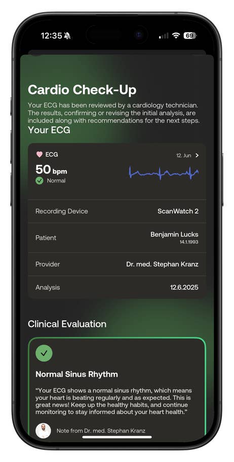 Summary of the cardio check-up with ECG results, assessment of normal sinus rhythm, and more.