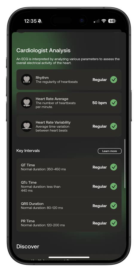 Cardiologist analysis screen with cardiac metrics: rhythm, average heart rate, and intervals.